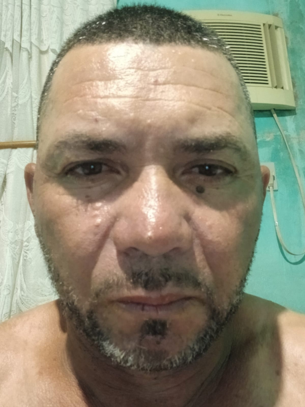 Doidão