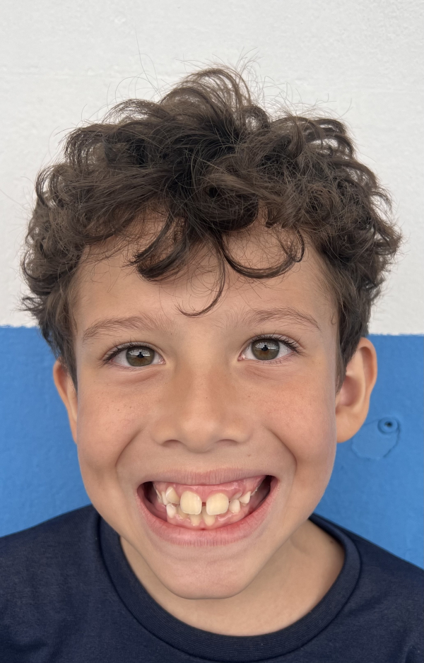 Bernardinho - Colégio Interativo Mogi 