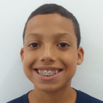kaue