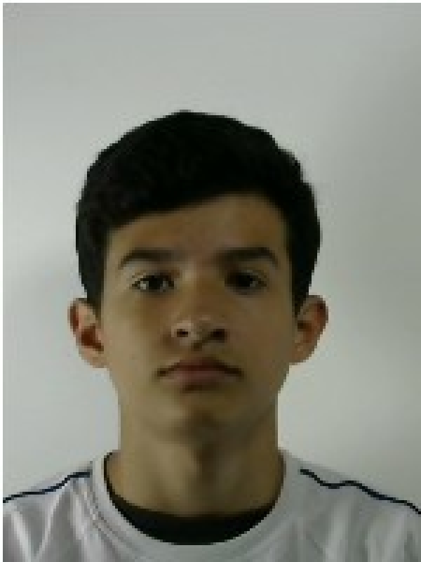 Acras - Brasilis 