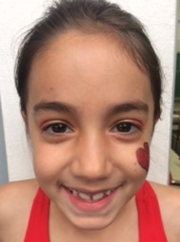 Yasmin
